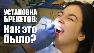 Я ПОСТАВИЛА БРЕКЕТЫ! Как это было?