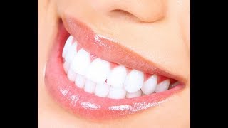 Teeth whitening at home // How to have natural white teeth in bengali