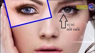 Xem ý nghĩa "TƯỚNG NỐT RUỒI" Trong mắt phải để biết về giàu sang phú quý hay nghèo khổ