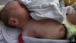 Newborn's pupik (Yiddish for belly button)