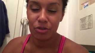 Tummy Tuck Drain Removal!! Stitches Removal!