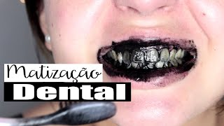 MATIZAÇÃO DENTAL - MASCARA O AMARELO DOS DENTES TEMPORÁRIO -  POR PAULA BORGES