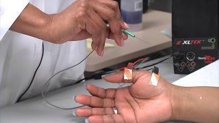 Elektromiyografi (EMG) Nasıl Çekilir?