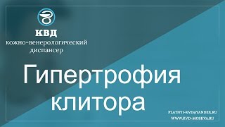 732  Гипертрофия клитора
