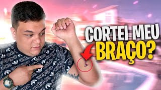 CORTEI MEU BRAÇO EM UM ACIDENTE! PAREI COM O FREE FIRE?!