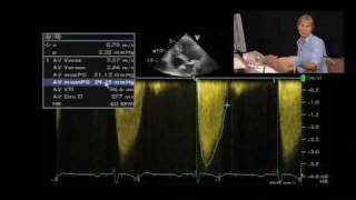 Low-Flow Aortic Stenosis