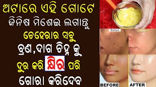 ଅଟା ରେ ଏହି ଗୋଟେ ଜିନିଷ ମିଶେଇ ଲଗାନ୍ତୁ ଥରେ ବ୍ୟବହାରରେ ହିଁ ମୁହଁ କ୍ଷୀର ଠାରୁ ବି ଅଧିକ ଚମକିବ | Skin Whitening
