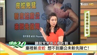以為落枕痠痛，沒想到是「皮蛇」纏身！民俗療法斬皮蛇？得過水痘就會中？健康2.0