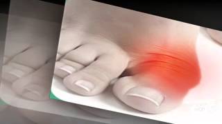 valgus pro отзывы

  - Valgus Pro - Обзор Фиксатора