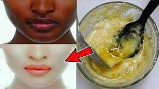আলু দিয়ে দুধের চাইতেও ধবধবে ফর্সা ত্বক পাওয়ার উপায়।ত্বক ফর্সা করার টিপস।How to Get Fair Skin