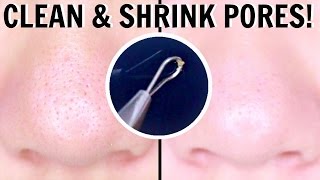 HOW TO EXTRACT & MINIMIZE PORES!!! | you wont regret this.