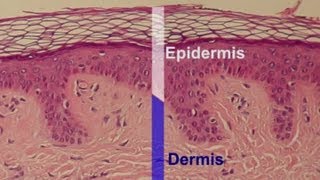 What Effect Does a Skin Peel Have & What Skin Layers Does It Remov... : Professional Skin Care Help