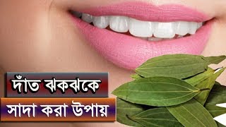 শুধুমাত্র তেজপাতা দিয়ে দাঁত ঝকঝকে সাদা করার উপায়
