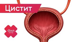 ЦИСТИТ Лечение | Как вылечить ЦИСТИТ дома | Как лечить цистит | Симптомы цистита