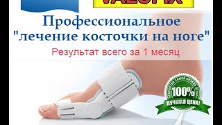 Valufix отзывы и обзор. Валюфикс профессиональный фиксатор косточки на ноге!