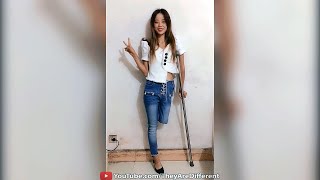 Lovely Amputee Girl Having Fun #14