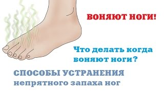 Воняют ноги // Что делать если воняют ноги // Как избавиться от запаха ног