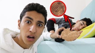 KARDEŞİM DELİKLİ EL HASTALIĞINA YAKALANDI !! (YARDIM EDİN)