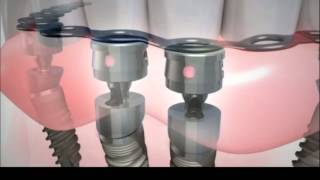 Съемное протезирование на имплантах