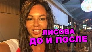 Настя Лисова до и после! Последние новости дома 2 (эфир 22 апреля, день 4365 )