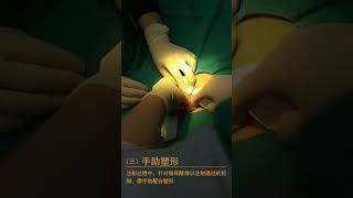 Penis augmentation by hyaluronic acid 玻尿酸注射阴茎增粗术