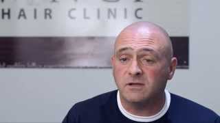 Scalp Micro Pigmentation Glasgow - Vinci Hair Clinic - Richard