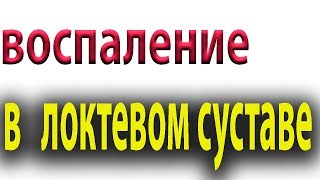 Как быстро убрать боль в локтевом суставе. Эпикондилит.Воспаление сухожилия#малиновский