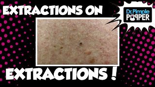Extractions on Extractions!