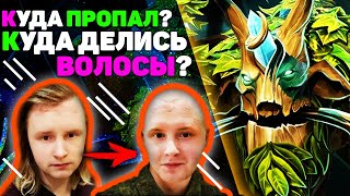 КУДА ПРОПАЛ? КУДА ДЕЛИСЬ ВОЛОСЫ? TREANT PROTECTOR DOTA 2. RD 71/1.