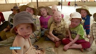 Knuffels en hulpgoederen gestolen van albinokinderen - RTL NIEUWS