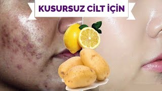 KUSURSUZ CİLT İÇİN LEKE GİDERİCİ YÜZ BEYAZLATICI PATATES LİMON MASKESİ (Tüm Ciltler İçin)