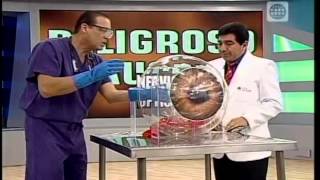 Dr. TV - B3 - Asistente del día: El Glaucoma
