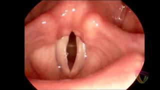 Speech-Language Pathology: The Vocal Cords in Action