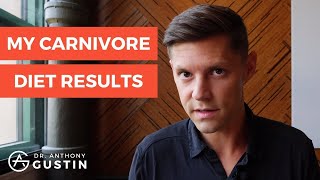 My Carnivore Diet Results and Q&A (5.5 Weeks Eating ONLY MEAT)