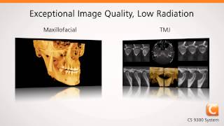 CARESTREAM CS 9300 for Point of Care ENT and Dental Imaging
