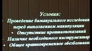 Как делают аборт. Факты без эмоций