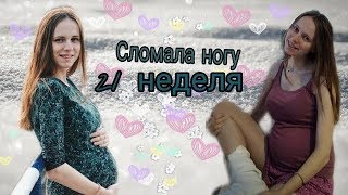 СЛОМАЛА НОГУ ВО ВРЕМЯ БЕРЕМЕННОСТИ | 21 НЕДЕЛЯ