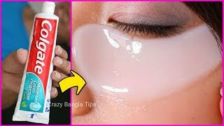 Colgate দিয়ে মাত্র ১ মিনিটে চোখের নিচের যম কালো দাগ(Dark Circle)দূর করার উপায়।Dark Circle Remove
