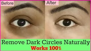 HOW TO REMOVE DARK CIRCLES AT HOME PERMANENTLY | डार्क सर्कल्स हमेशा के लिए कैसे हटाए