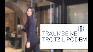 Traumbeine trotz Lipödem?