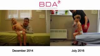 BDA Improvement