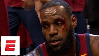 Thaddeus Young catches LeBron James on the head, causing him to bleed | ESPN