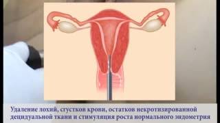 Видеоруководство по применению аппаратов "ФОТЕК" серии АК-100 в акушерстве и гинекологии