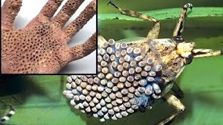 10 Самых Пугающих УКУСОВ Насекомых!