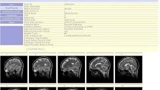 cloud based, pacs web portal to view dicom studies