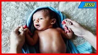 How Do I Care for My Baby After His Circumcision?