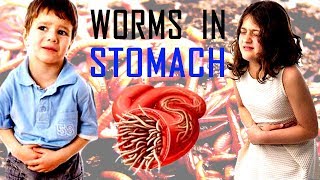 How To Prevent Your Child From Stomach Worms | worms in kids | Parasite treatment in hindi