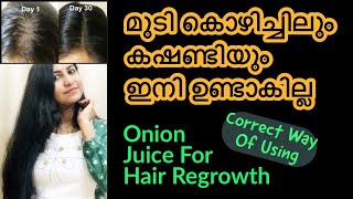 മുടി തഴച്ചു വളരാൻ|Home Remedy For Baldness&Hair Regrowth|Correct Way Of Using Onion Juice|HairGrowth