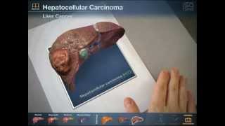 INTERACTIVE - Augmented Reality Liver Viewer: Anatomy App