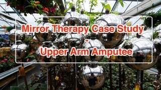Mirror Therapy Case Study - Upper Arm Amputee